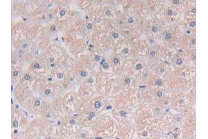 Detection of PLCg1 in Human Liver Tissue using Polyclonal Antibody to Phospholipase C Gamma 1 (PLCg1)