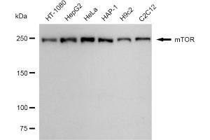 Western blotting analysis using mTOR antibody (ABIN7799347).