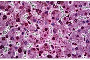 Human Liver: Formalin-Fixed, Paraffin-Embedded (FFPE)