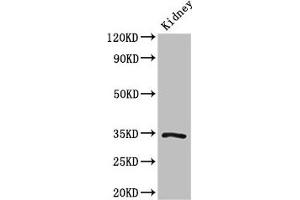Western Blot Positive WB detected in: Mouse kidney tissue All lanes: KLF7 antibody at 3 μg/mL Secondary Goat polyclonal to rabbit IgG at 1/50000 dilution Predicted band size: 34, 30, 25, 31, 14, 10 kDa Observed band size: 34 kDa (KLF7 anticorps  (AA 114-220))