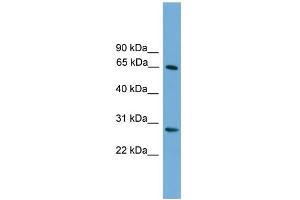 WB Suggested Anti-FBXW8 Antibody Titration: 0. (FBXW8 anticorps  (Middle Region))