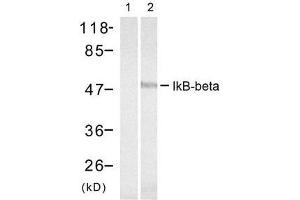 Western blot analysis of extract from 293 cells treated with TNF-α, using IκB-β (Ab-23) antibody (E021304, Lane 1 and 2). (NFKBIB anticorps)