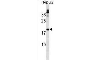 Western Blotting (WB) image for anti-Lipoma HMGIC Fusion Partner (LHFP) antibody (ABIN2999873) (LHFP anticorps)