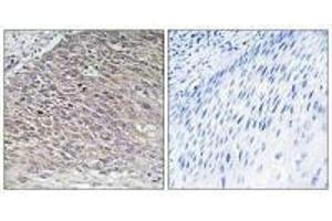 Immunohistochemistry analysis of paraffin-embedded human testis tissue using MAST4 antibody. (MAST4 anticorps)