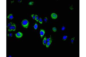 Immunofluorescent analysis of A549 cells using ABIN7157739 at dilution of 1:100 and Alexa Fluor 488-congugated AffiniPure Goat Anti-Rabbit IgG(H+L)