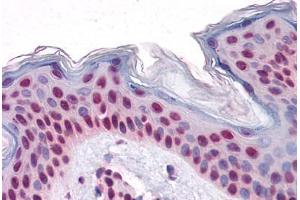 Human Skin: Formalin-Fixed, Paraffin-Embedded (FFPE)