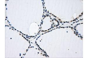 Image no. 9 for anti-Glucan (1,4-alpha-), Branching Enzyme 1 (GBE1) antibody (ABIN1498396)