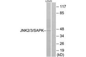 Western blot analysis of extracts from LOVO cells, using SAPK/JNK (Ab-183) Antibody. (SAPK, JNK (AA 166-215) anticorps)