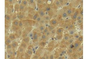 Detection of APOM in Human Liver Tissue using Polyclonal Antibody to Apolipoprotein M (APOM)