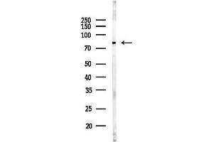 Western blot analysis of lysates from K562 cells, using eEF2K Antibody at 1/1000 dilution.
