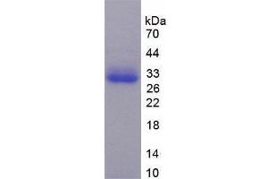 SDS-PAGE analysis of Human TRADD Protein.