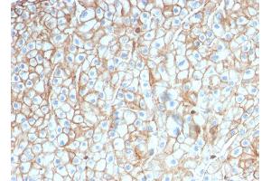 ABIN6383847 to PD-L1 was successfully used to stain membranes of carcinomas in human lung, cervex and breast sections. (PD-L1 anticorps  (Extracellular Domain))