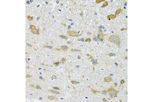 Immunohistochemistry of paraffin-embedded mouse spinal cord using CCT4 antibody.