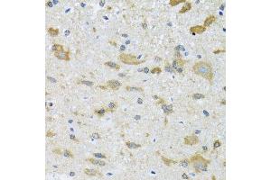 Immunohistochemistry of paraffin-embedded mouse spinal cord using CCT4 antibody. (CCT4 anticorps  (AA 130-390))