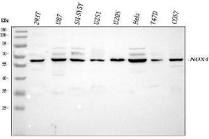 Western blot analysis of NOX4 using anti-NOX4 antibody (ABIN5692899).