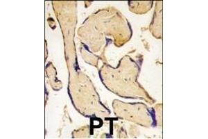 Formalin-fixed and paraffin-embedded human placenta tissue reacted with EphA3 antibody (C-term ), which was peroxidase-conjugated to the secondary antibody, followed by DAB staining. (EPH Receptor A3 anticorps  (C-Term))
