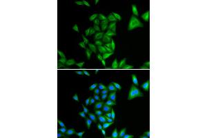 Immunofluorescence analysis of U2OS cells using PHYH antibody (ABIN5973726). (PHYH anticorps)