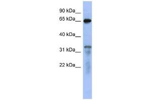 RAP1GAP antibody used at 1 ug/ml to detect target protein. (RAP1GAP anticorps  (Middle Region))