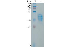 Human VWF(1596-1668) Protein, hFc Tag on SDS-PAGE under reducing condition.
