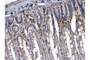 IHC analysis of Cytoglobin using anti- Cytoglobin antibody .