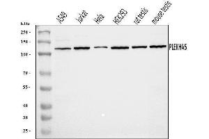 Western blot analysis of PEPP2/PLEKHA5 using anti-PEPP2/PLEKHA5 antibody (ABIN7600924).
