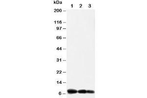 Western blot testing of IP10 antibody and Lane 1:  recombinant human protein 10ng;  2: 5ng;  3: 2.