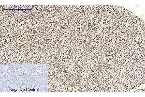 Immunohistochemical analysis of paraffin-embedded human uterus tissue. (CDK2 anticorps  (AA 200-280))