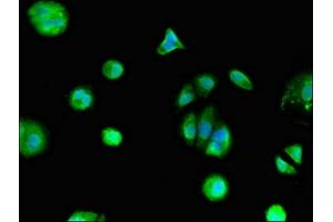 Immunofluorescent analysis of MCF-7 cells using ABIN7153311 at dilution of 1:100 and Alexa Fluor 488-congugated AffiniPure Goat Anti-Rabbit IgG(H+L) (Mesothelin anticorps  (AA 1-62))