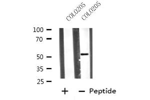 Western blot analysis of extracts from COLO205 cells, using VRK3 antibody. (VRK3 anticorps  (Internal Region))