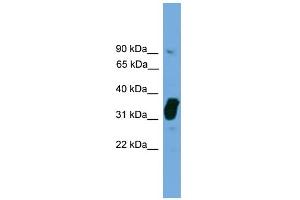 WB Suggested Anti-NOSIP Antibody Titration: 0. (NOSIP anticorps  (Middle Region))