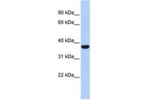 Image no. 1 for anti-Exosome Component 2 (EXOSC2) (AA 143-192) antibody (ABIN6740694) (EXOSC2 anticorps  (AA 143-192))