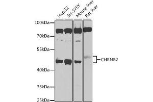 Western blot analysis of extracts of various cell lines, using CHRNB2 antibody (ABIN6131327, ABIN6138590, ABIN6138592 and ABIN6225110) at 1:1000 dilution.