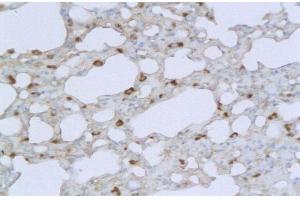 Formalin-fixed and paraffin embedded mouse lung labeled with Anti TMPRSS2 Polyclonal Antibody, Unconjugated  followed by conjugation to the secondary antibody and DAB staining