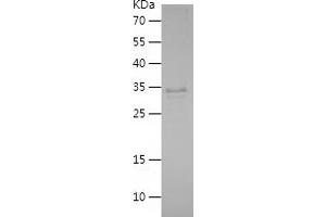Western Blotting (WB) image for Prostate Stem Cell Antigen (PSCA) (AA 12-86) protein (His-IF2DI Tag) (ABIN7124611)
