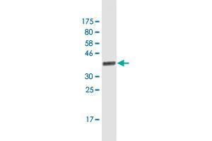 Western Blot detection against Immunogen (37.