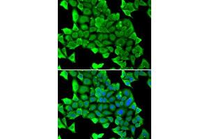 Immunofluorescence analysis of U2OS cells using MYH1 antibody.