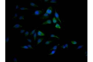 Immunofluorescence staining of Hela Cells with ABIN7127802 at 1:50, counter-stained with DAPI. (Recombinant SAE1 anticorps)