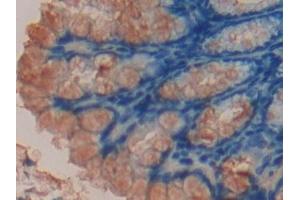 Detection of CCND2 in Mouse Intestine Tissue using Polyclonal Antibody to Cyclin D2 (CCND2) (Cyclin D2 anticorps  (AA 47-267))