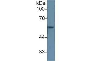 Western Blot; Sample: Rat Skin lysate; Primary Ab: 1µg/ml Rabbit Anti-Human KRT6A Antibody Second Ab: 0.