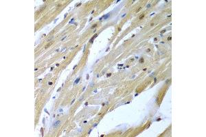Immunohistochemistry of paraffin-embedded mouse heart using TUSC2 antibody at dilution of 1:200 (40x lens). (TUSC2 anticorps)