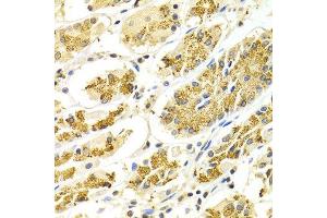 Immunohistochemistry of paraffin-embedded Human gastric using ATP6AP1 antibody at dilution of 1:100 (x400 lens). (ATP6AP1 anticorps  (AA 90-390))