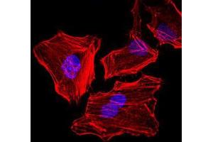 Immunofluorescence analysis of HeLa cells.