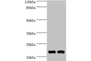 Western blot All lanes: Neuronal calcium sensor 1 antibody at 10 μg/mL Lane 1: Hela whole cell lysate Lane 2: Rat kidney tissue Secondary Goat polyclonal to rabbit IgG at 1/10000 dilution Predicted band size: 22, 20 kDa Observed band size: 22 kDa (NCS1 anticorps  (AA 1-190))