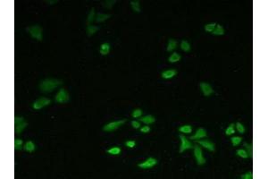 Detection of ATXN10 in Hela cells using Polyclonal Antibody to Ataxin 10 (ATXN10)