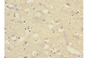 Immunohistochemistry of paraffin-embedded human brain tissue using ABIN7170966 at dilution of 1:100 (SAE1 anticorps  (AA 1-346))
