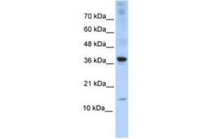 Image no. 1 for anti-Basic Leucine Zipper ATF-like Transcription Factor (BATF) (AA 35-84) antibody (ABIN6740310)