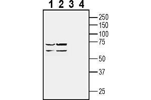 Western blot analysis of human  retinal cell epithelium cell line lysate (lanes 1 and 3) and Malme-3M melanoma cell line lysate (lanes 2 and 4):1-2. (GPR143 anticorps  (Intracellular))