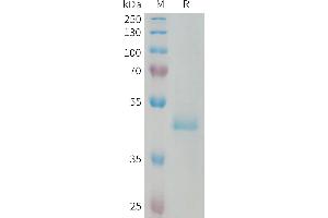 Human PIP Protein, hFc Tag on SDS-PAGE under reducing condition.