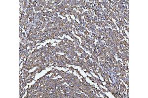 IHC analysis of MIM/MTSS1 using anti-MIM/MTSS1 antibody (ABIN7600276). (MTSS1 anticorps  (AA 17-692))