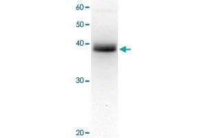 Detection of XPA protein in crude extract of HeLa cell by western blotting, using XPA monoclonal antibody, clone 5F12 . (XPA anticorps)